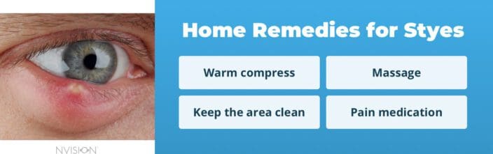 How to Get Rid of a Stye Quickly: At-Home Remedies &amp; Medical Treatment