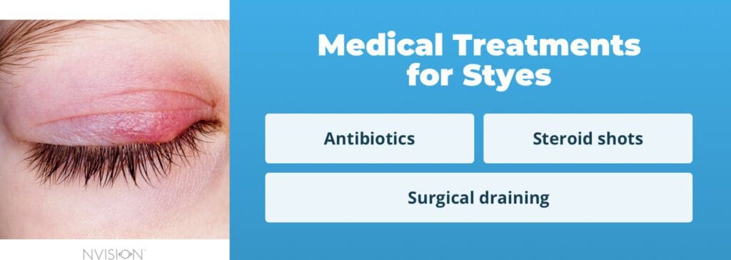 Medical Treatments for Styes