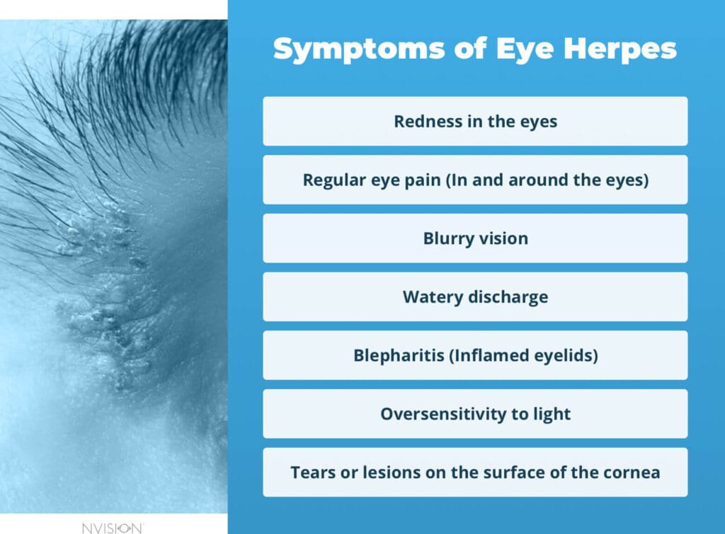 Eye Herpes Causes, Treatment & What Not to Do NVISION Eye Centers