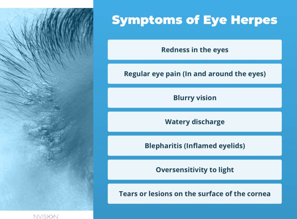 Symptoms of Eye Herpes