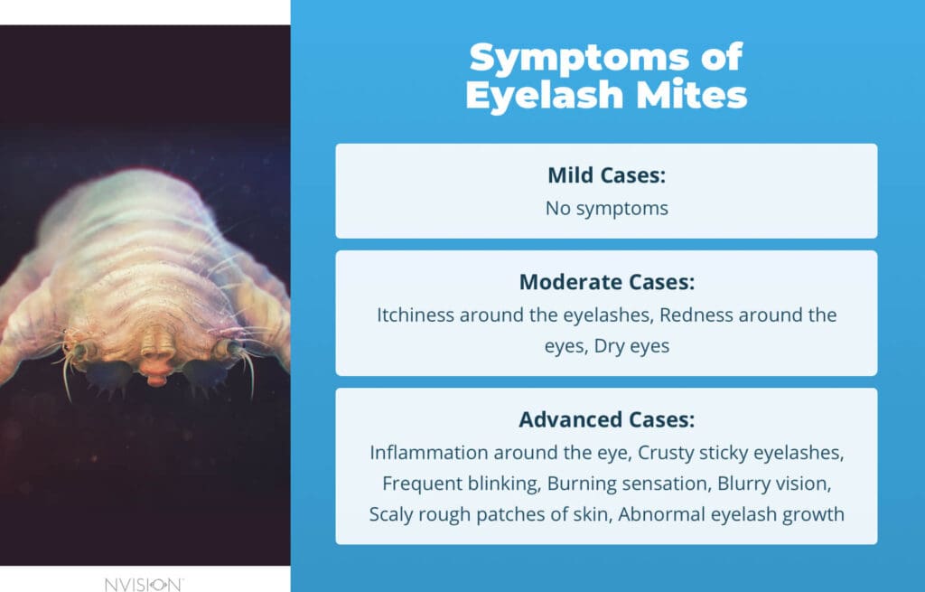Symptoms of Eyelash Mites