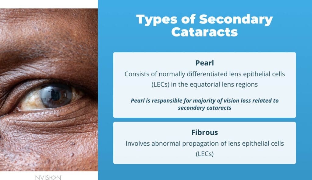 Types of Secondary Cataracts