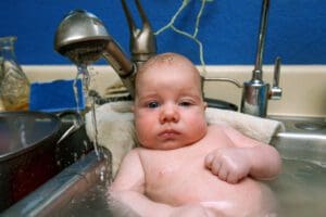 baby with ptosis