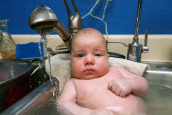 baby with ptosis