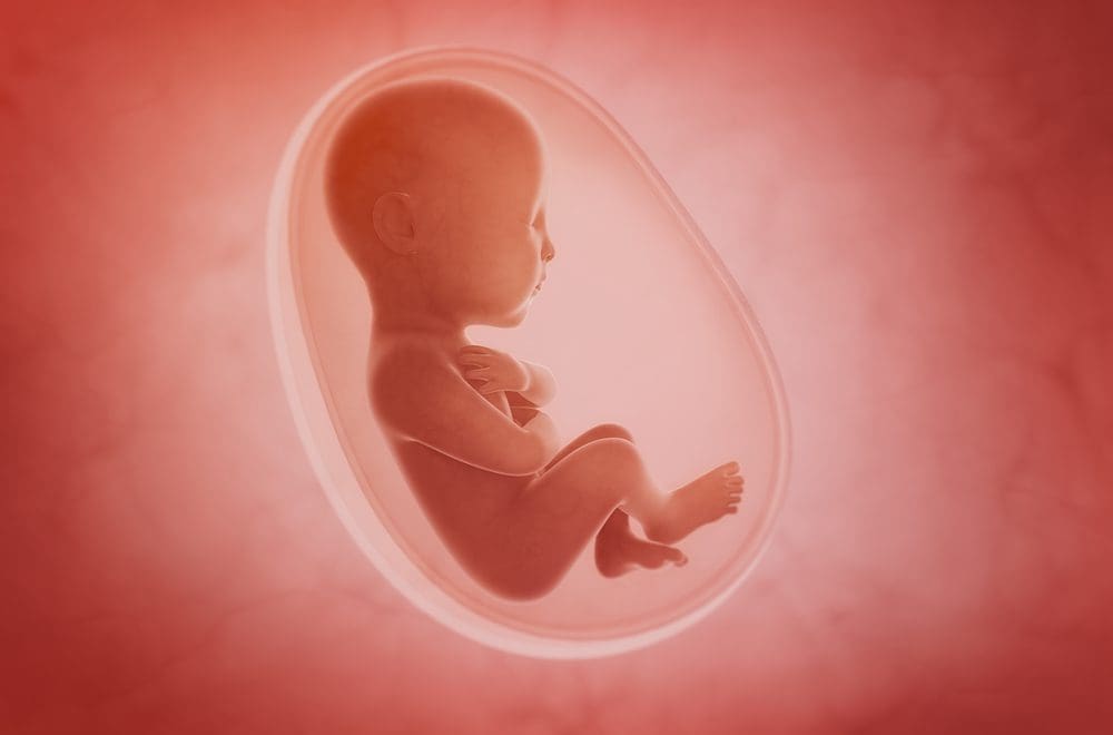 Coloboma is a birth ...