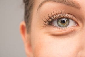 How to Get Rid of UnderEye Bags According to Experts  Who What Wear UK