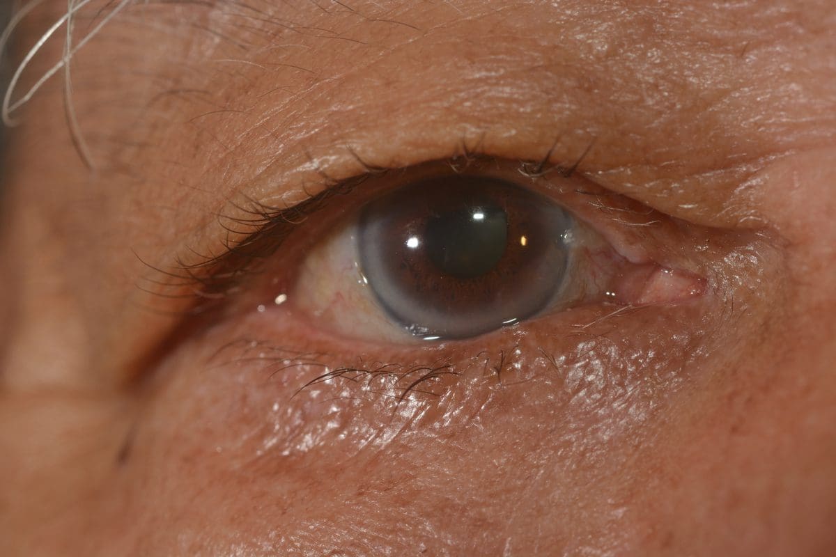 Premium Photo | A close up of a blue eye with a pink ring around the eye.