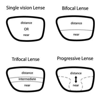 Trifocal Gl Vs Other Options