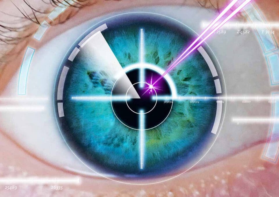 eye laser correction