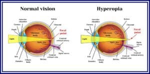 Reading Glasses Power Chart By Age