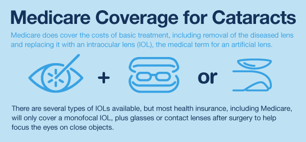 Medicare Coverage Of Cataract Surgery What s Included Extras
