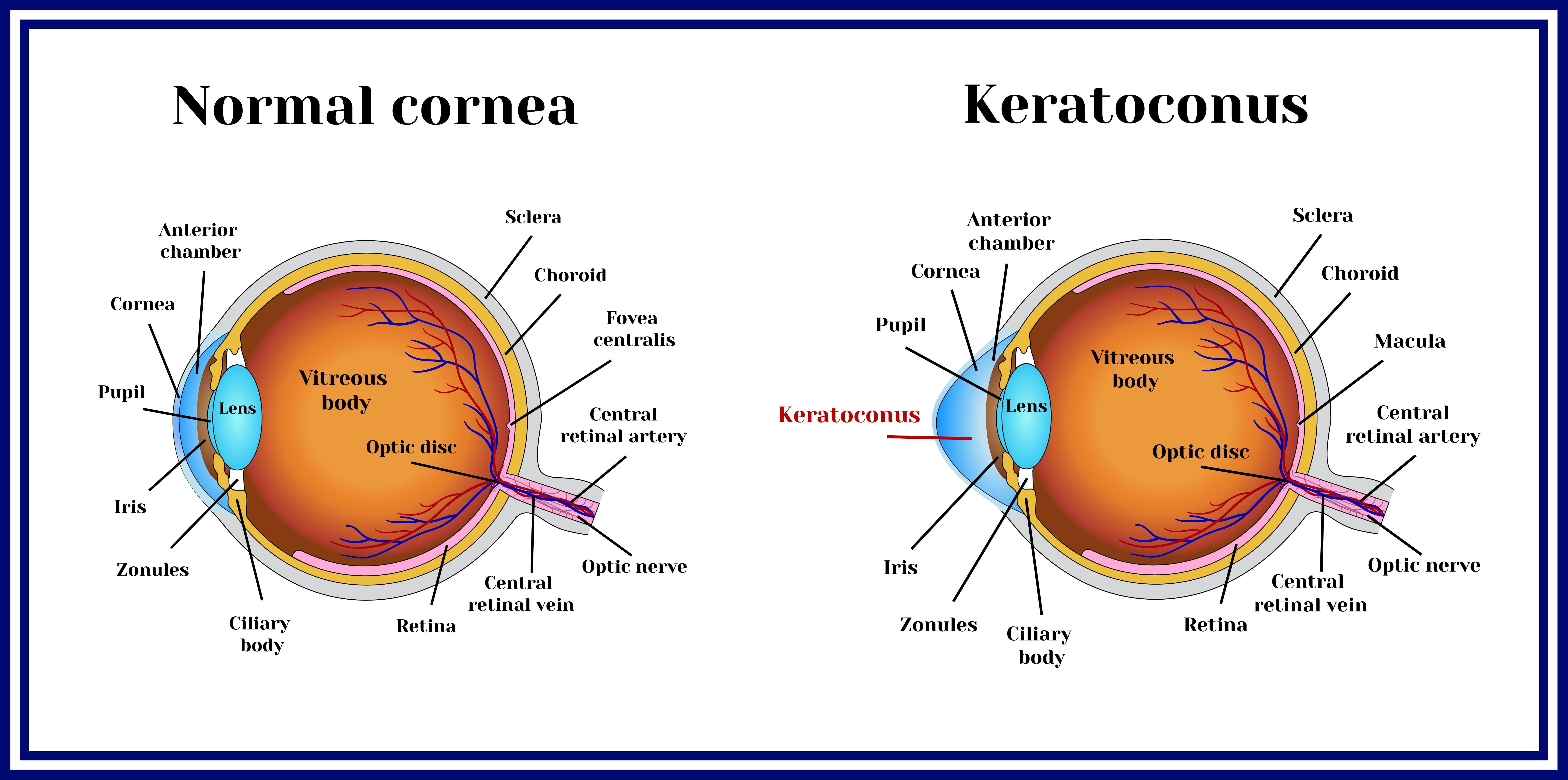 The cornea is the cl...