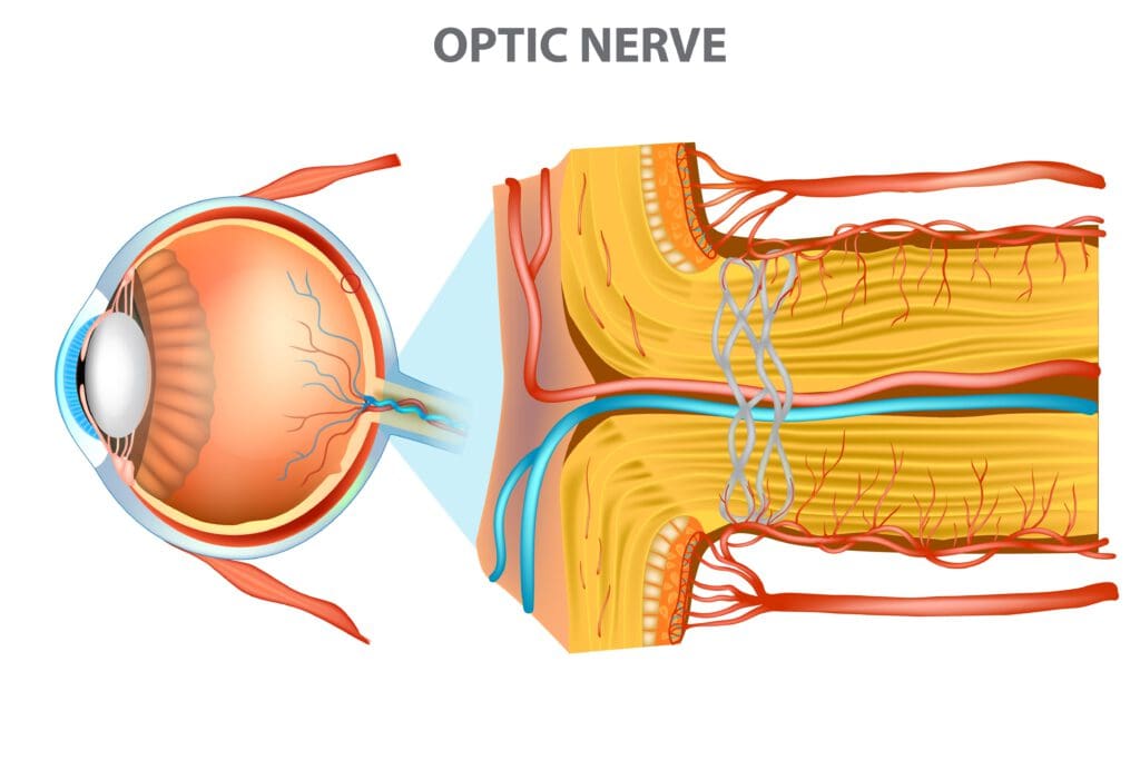 Optic Neuropathy What Is It & Can You Reverse It? NVISION Eye Centers