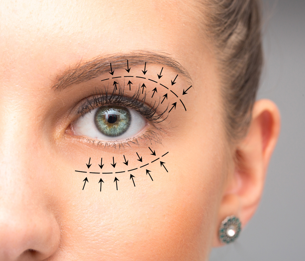 Blepharoplasty Surgery: Costs, Recovery,  More | NVISION Eye Centers