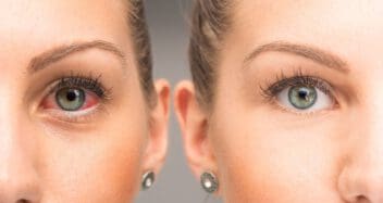 red eye vs non red