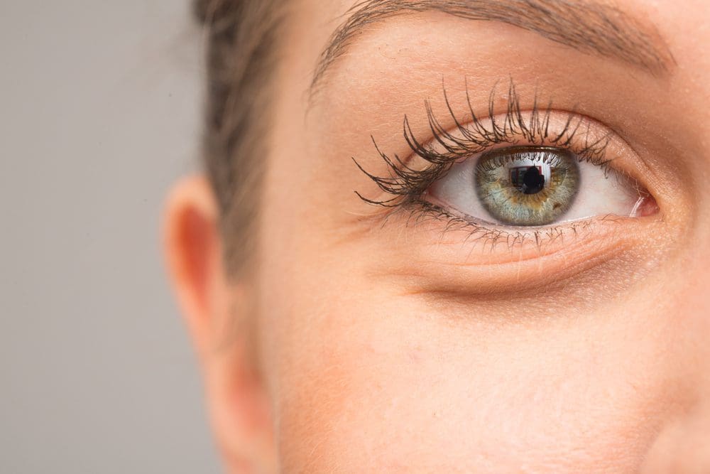 When Are the Dark Circles Under Your Eyes Not Down to Being Tired?