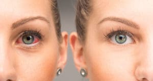 woman with red eyes